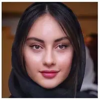 ترلان پروانه واقعا عمل زیبایی انجام نداده؟