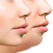 وزن و پوست، ارتباطی پنهان