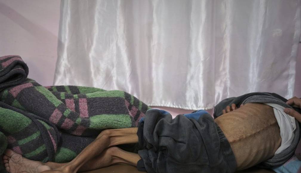 مقام‌های فلسطینی: 65هزار کودک در غزه با خطر مرگ ناشی از سیاست گرسنگی اسرائیل مواجه هستند