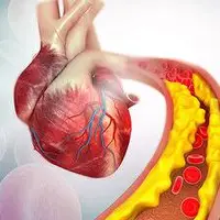 کاهش کلسترول خون با مصرف این سبزی