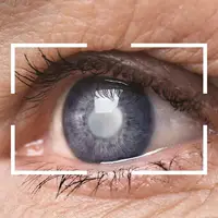 مشکل کمبود لنز چشم در یزد تا ۱۰ روز آینده حل می‌شود