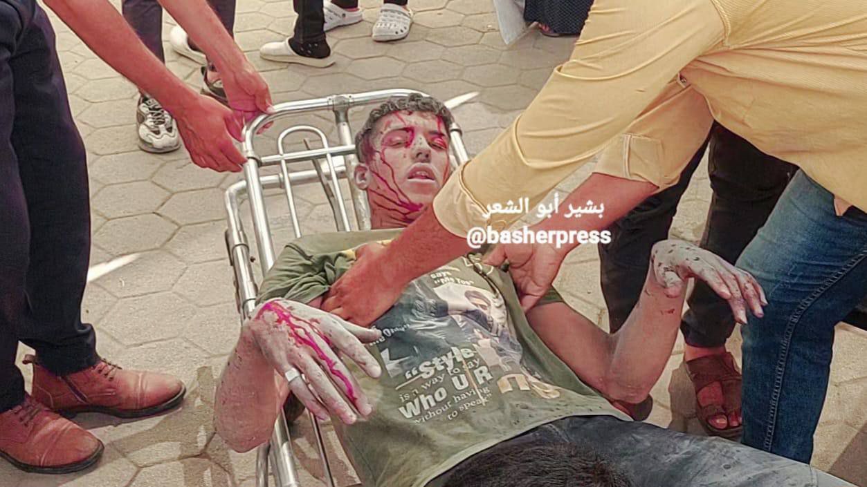 عکس/ شهادت دو جوان فلسطینی در غزه حین جستجوی غذا