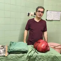 خارج‌کردن توده ۱۰ کیلویی از شکم بیمار پس از سال‌ها درد