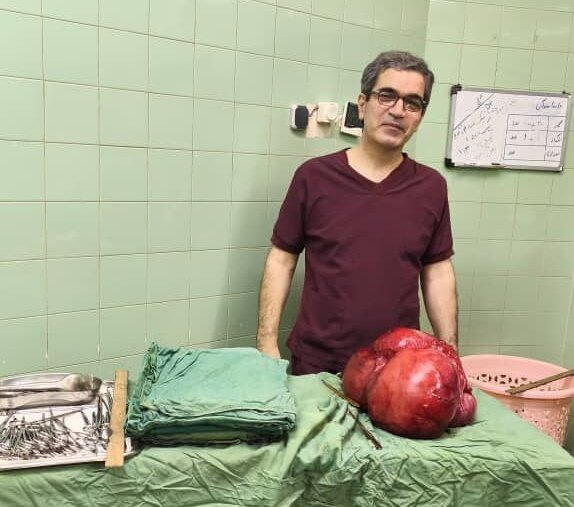خارجکردن توده ۱۰ کیلویی از شکم بیمار پس از سالها درد