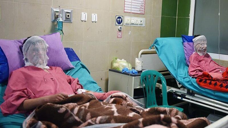 مدیرکل پزشکی قانونی: سوختگی سال گذشته سبب مرگ ۳۰ نفر در البرز شد
