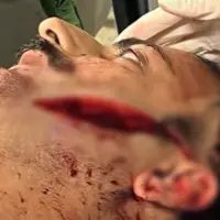 قمه‌کشی اراذل صورت مرد ۳۷ ساله را فلج کرد