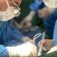 آمادگی مالزی برای استفاده از تجربیات ایران در پیوند کبد و کلیه