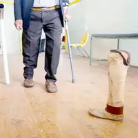 خانه‌نشینی معلولان با گرانی پروتزها