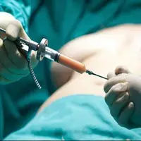 بوتاکس برای کاهش وزن؟/ جراح عمومی پاسخ داد