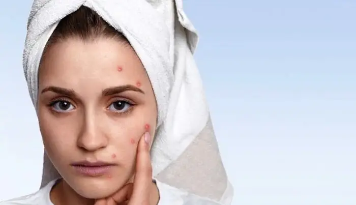 آنچه درباره تایم لاین پوست خود باید بدانید