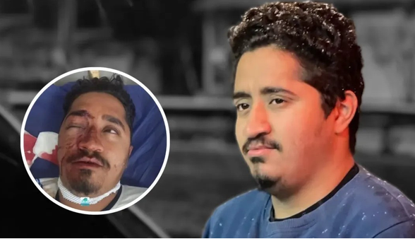 خبرنگار گیلانی در فینال جام حذفی نابینا شد