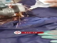 نجات معجزه‌آسا کارگر ساختمانی پس از سقوط بر روی میلگرد