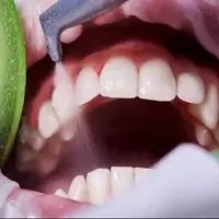 دشمن خاموش سلامت دهان