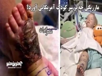 نجات معجزه‌آسای دختر ۱۵ ماهه پس از گزش مار زنگی در آریزونا