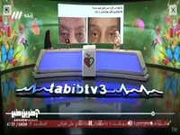 آیا بوتاکس می‌تواند جایگزینی برای بلفاروپلاستی باشد؟ 