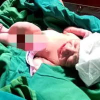 تولد نوزاد از مادری که با پیوند عضو زندگی دوباره یافت