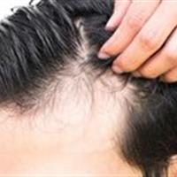 بهترین مواد غذایی برای توقف کامل ریزش مو
