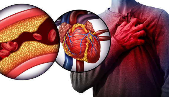 آیا فشار خون بالا همیشه به مشکلات قلبی برمی‌گردد؟