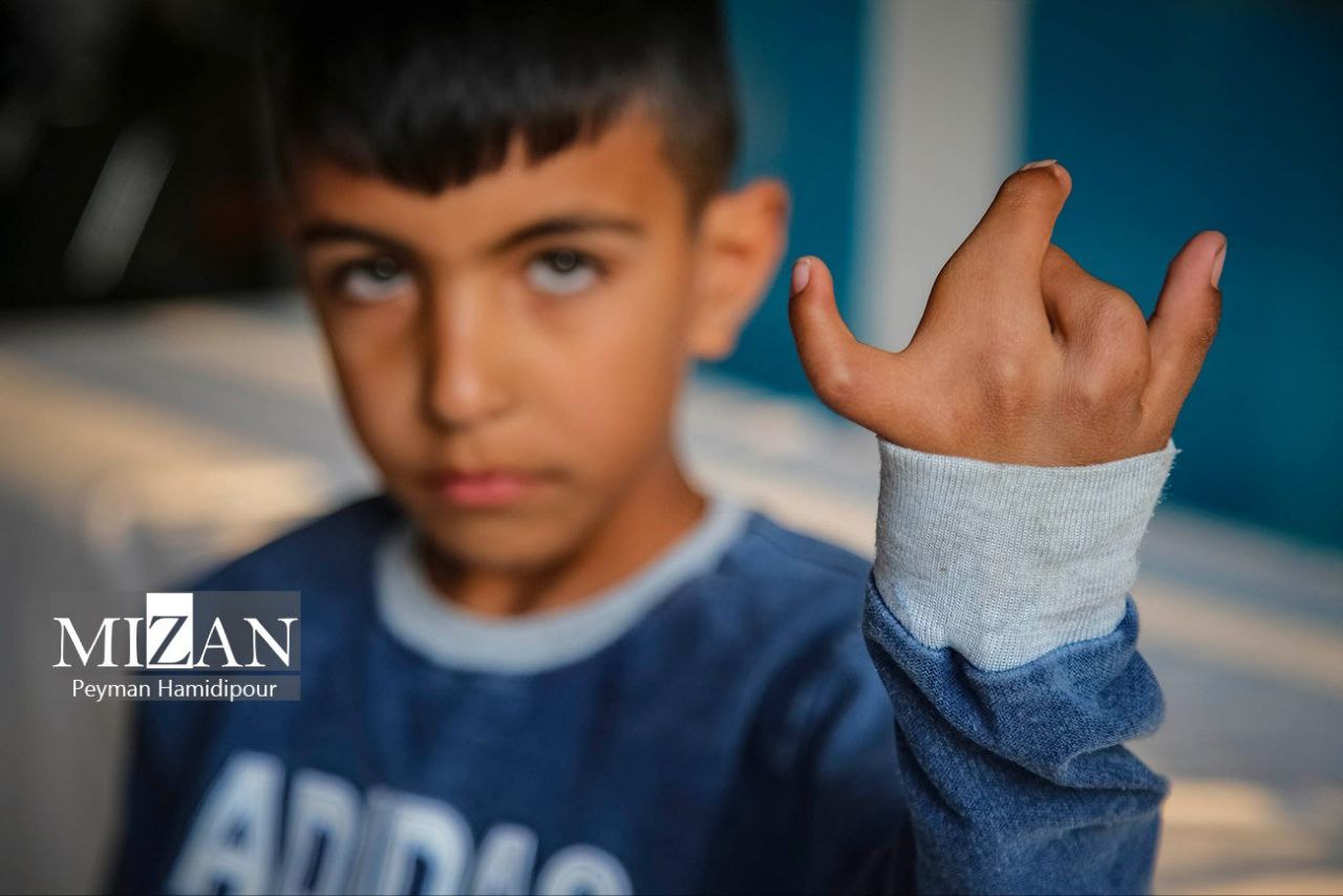 عکس/ پزشکان و متخصصان پای کار جراحی رایگان کودکان با ناهنجاری‌های مادرزادی