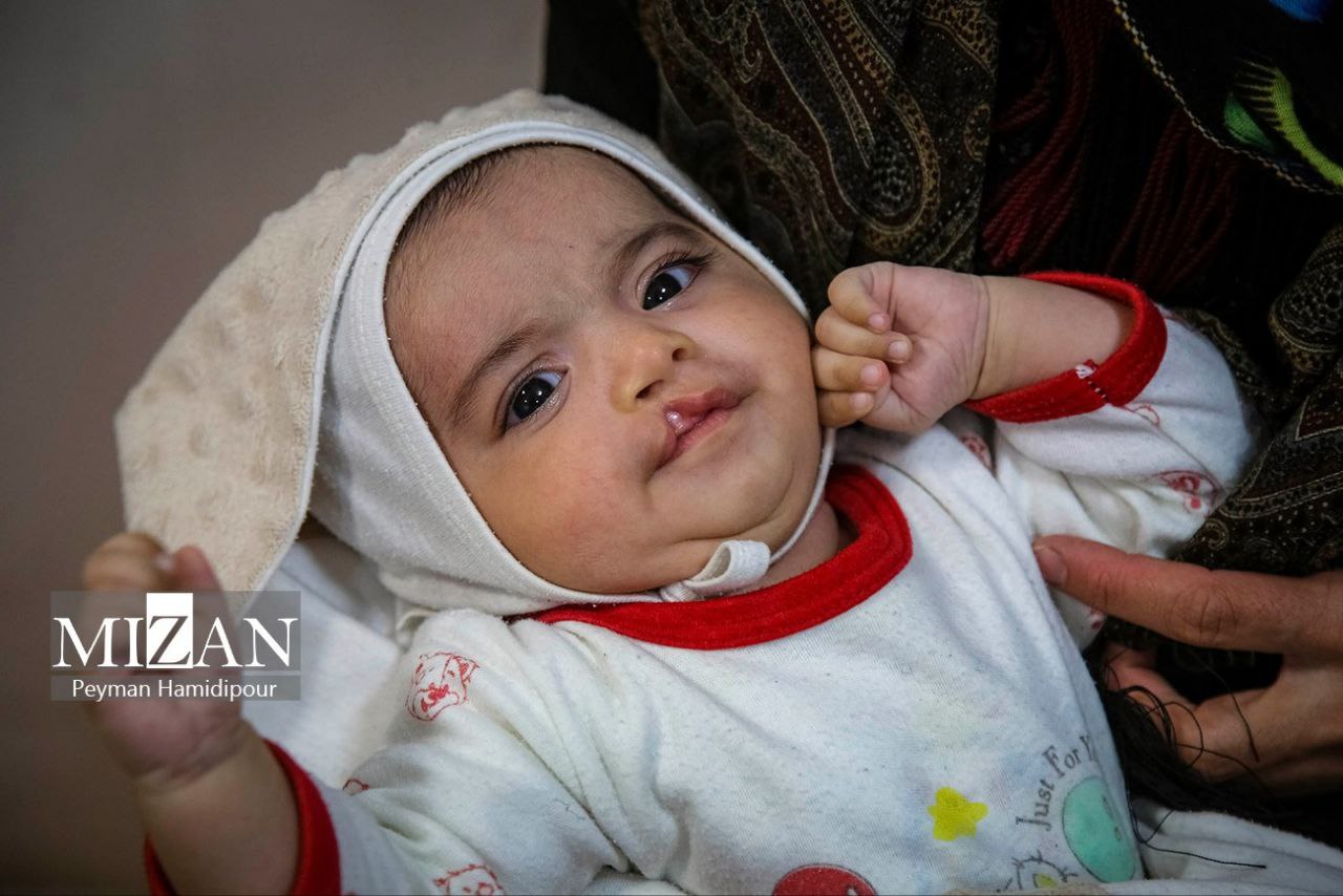 عکس/ پزشکان و متخصصان پای کار جراحی رایگان کودکان با ناهنجاری‌های مادرزادی