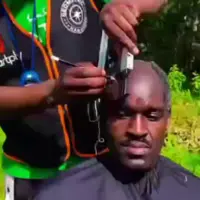 کاشت مو با هزینه مناسب!