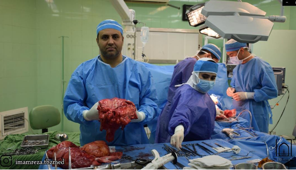 خارج کردن توده ۲۰ کیلویی از شکم یک مرد ۶۵ ساله در تبریز
