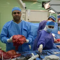 خارج کردن توده ۲۰ کیلویی از شکم یک مرد ۶۵ ساله در تبریز