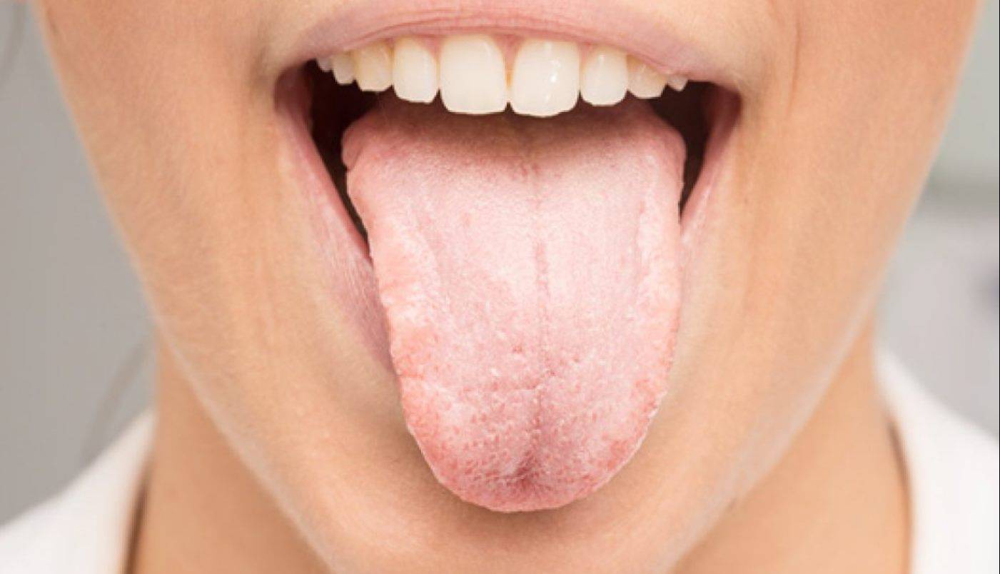 زبان سفید چه حرف‌هایی با خود دارد؟