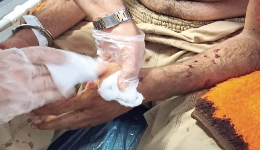 درگیری هولناک با سلاحهای شکاری در روستای احمدآباد مشهد