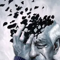 تشخیص ۹ نوع زوال عقل با یک اسکن توسط هوش مصنوعی
