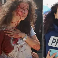 زخمی‌شدن خبرنگار فلسطینی در حمله اسرائیل به غزه