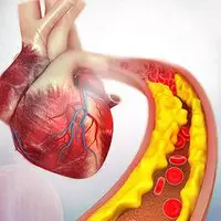 خوراکیهایی که کلسترول بد را کاهش میدهند