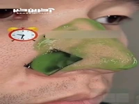ترکیبی که به رفع منافذ باز پوست و جوشهای سرسیاه خیلیی کمک میکنه!