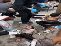 جراحت کودکان فلسطینی در حملات رژیم صهیونیستی به غزه