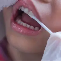 تأثیر استرس بر دهان و دندان