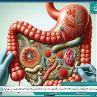 محققان ایرانی ترکیب میکروبی معده بیماران را بررسی کردند