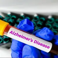 در معرض ابتلا به آلزایمر هستید؟/ چهار مسیر منتهی به این بیماری را بشناسید