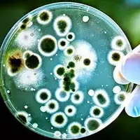 شناسایی 8 مبتلا به بیماری سیاه زخم در چهارمحال و بختیاری