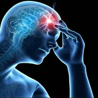 سکته‌های مغزی مکرر می‌توانند به زوال عقل عروقی منجر شوند