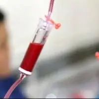 نکاتی جالب درباره این بیماری خونی و ژنتیکی
