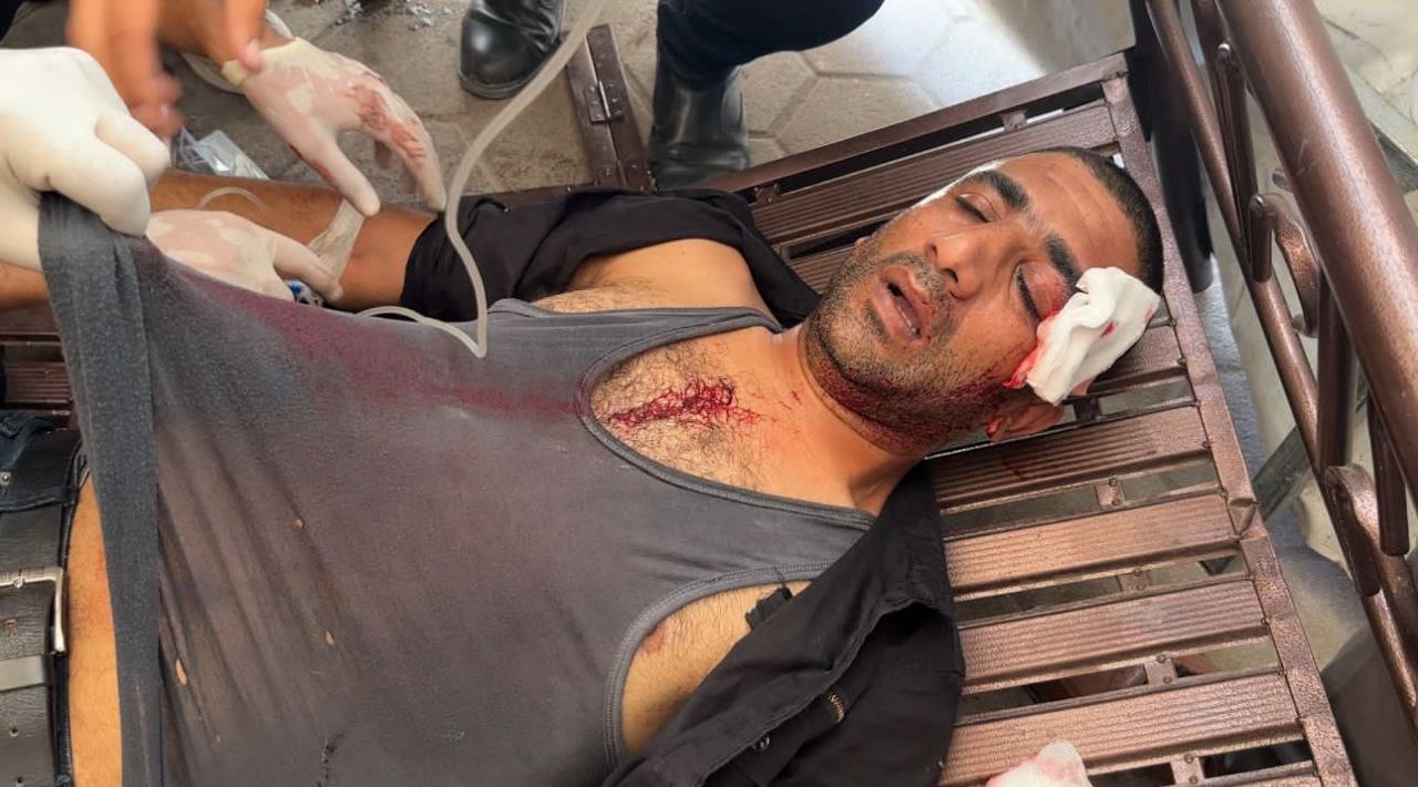  زخمی شدن خبرنگار شبکه المیادین در غزه  