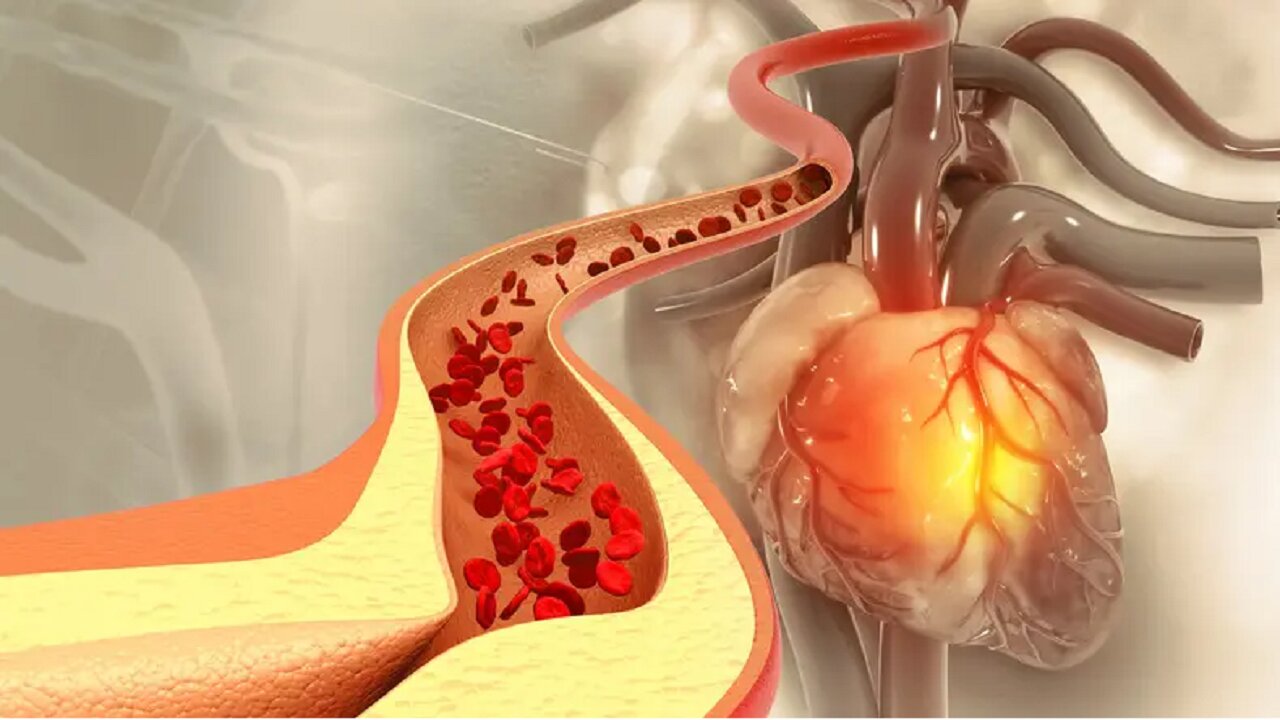 این پنج خوراکی به طور طبیعی کلسترول بد را کاهش میدهد