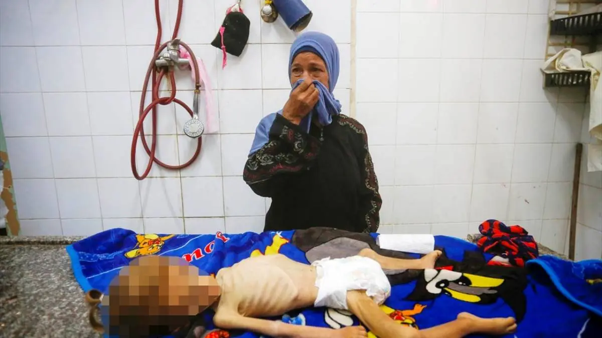 عکس/ مرگ کودک فلسطینی بر اثر سوءتغذیه در غزه
