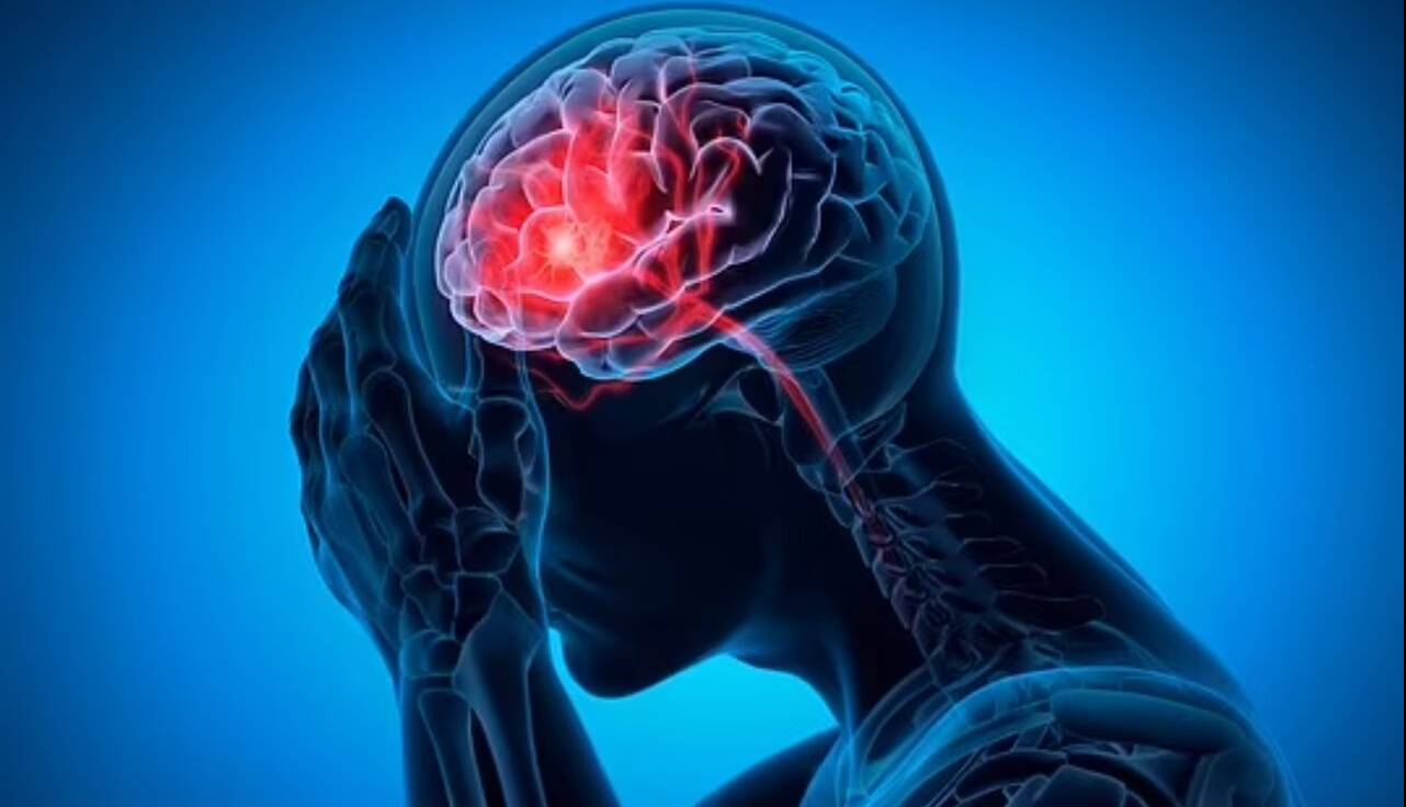 شایعترین علت خونریزی مغزی را بشناسیم