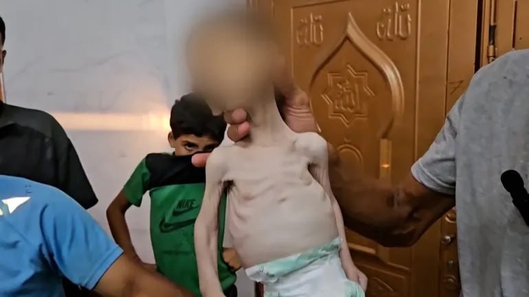عکس/ گرسنگی در غزه؛ سلاح خاموش اما مرگبار