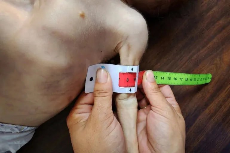 عکس/ گرسنگی در غزه؛ سلاح خاموش اما مرگبار