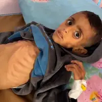 عکس/ گرسنگی در غزه؛ سلاح خاموش اما مرگبار