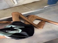 کارزار گرسنگی اسرائیل جان یک کودک دیگر را هم گرفت