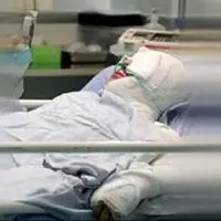 «خواهر»، قربانی اسیدپاشی برادر سنگدل شد!