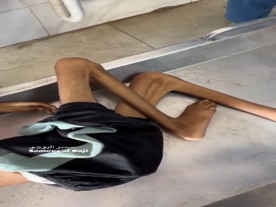 کارزار گرسنگی اسرائیل جان یک کودک دیگر را هم گرفت